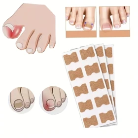 Complete Toenail Correction Kit 30 pcs