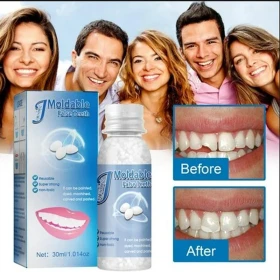 Temporary Tooth Repair Kit